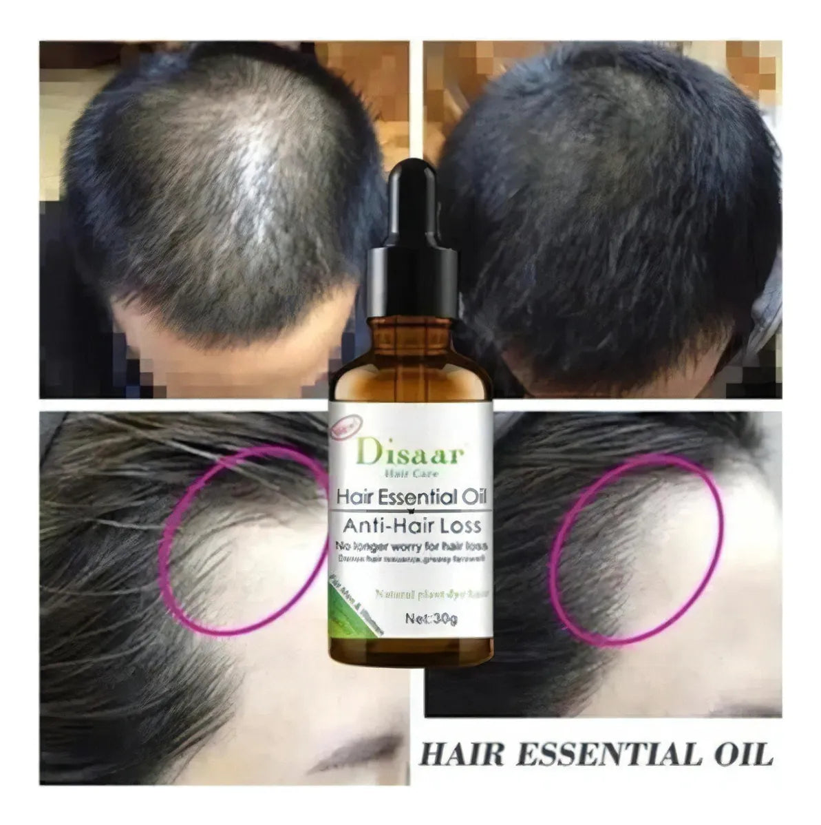 ACEITE ANTICAÍDA DISAAR HAIR CARE